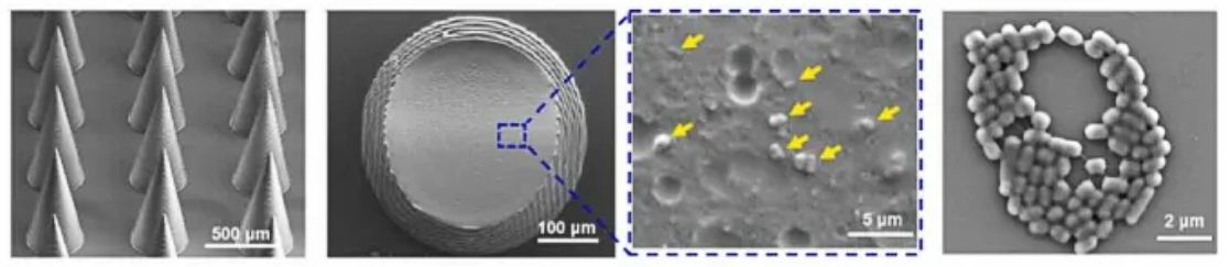 microneedles